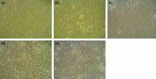 Vero cells are a lineage of cells used in cell cultures. Cytopathic Effects Cpe On Vero Cell Was Inhibited By Pretreatment Download Scientific Diagram