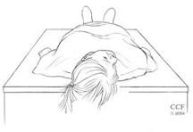 Image result for bppv treatment which side