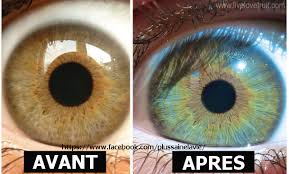 La couleur des yeux de pixel a changé, oui, mais progressivement, et pour les deux yeux. Temoignage Voici Comment Mes Yeux Ont Change De Couleur Apres Avoir Mange Une Alimentation Vegan Crue Pendant 6 Ans