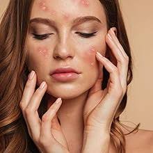 Annabis BALCANN Oak Tree Bark Gel