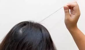 Image result for Hair Pull Test