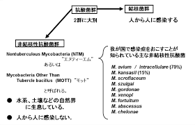 Contribute to fqnews/bnews development by creating an account on github. éžçµæ ¸æ€§æŠ—é…¸èŒç—‡ Kompas