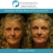 PSCC By Heidi Palma, Pacifica, CA 94044, US