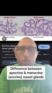 Apocrine vs. Merocrine Sweat Glands: Understanding the Key Differences
