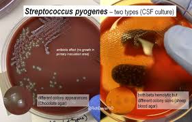 Image result for CSF Culture