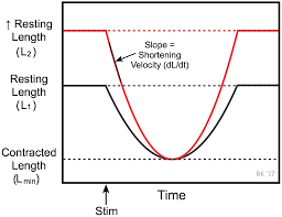 Image result for Preload