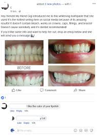 If you notice a chipped or broken filling, see your dentist to have it repaired. Tooth Sensitivity Weeks After Filling Reddit