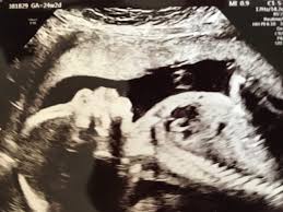 We did not find results for: Anatomy Scan And 4d Ultrasound In Japan