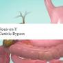 gastric bypass surgery from www.mayoclinic.org