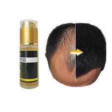 How to make hair growth spray add 8 drops each of lavender, peppermint, frankincense, rosemary, tea tree, and cedarwood essential oil to a spray bottle. Brand Customized Wholesale Hair Growth Oil With Mint How You Make Your Hair Grow Buy Hair Growth Exiler Kit Brazilian Hair Bundles Human Hair Grows Dermaroller Spray Hair Loss Product On Alibaba Com