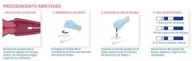 El líquido amniótico se encarga de envolver y proteger al bebé durante todo el embarazo, su volumen varía a lo largo de todo el proceso, pero pueden existir problemas por exceso de cantidad o por defecto. Qiagen Amnisure Prueba Rapida Confiable Y No Invasiva Para La Deteccion Precisa De La Ruptura Prematura De Membrana Fetal Rpmf