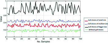 What cup size is considered large? A Novel Image Based Method For Detection And Measurement Of Gall Stones Springerlink