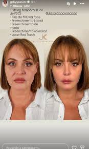 Gaby Spanic se somete a tratamiento estético y regresa a la juventud- Grupo  Milenio