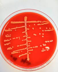 Image result for Staphylococcus Saprophyticus