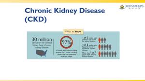 Renal disease can be divided into disease without failure of kidney function and kidney failure itself, which divides into chronic and acute forms. Abcs Of Kidney Disease Causes And Stages Of Chronic Kidney Disease Ckd Youtube