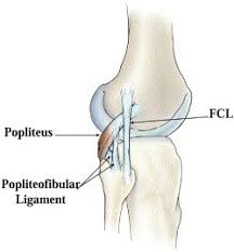 The aim of taping for a lateral knee ligament sprain is to provide support and protection to the injured ligament. Reconstruction Of The Posterolateral Corner Of The Knee Arthroscopy