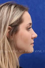 Facial Plastic Surgery Oklahoma City