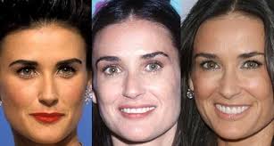She is not an actress . Liposuction Archives