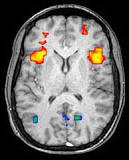 Image result for compare and contrast different structural neuroimaging techniques