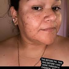 TOP 10 BEST Laser near Porter Ranch, Los Angeles, CA