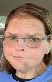 Why are there no photos of Darlie's mouth injuries?