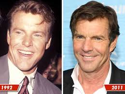 Dennis Quaid -- Good Genes or Good Docs?