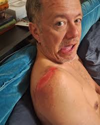 When you hit the ground, you clean up your wounds and focus