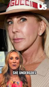 #RHOC’s Vicki Gunvalson claims she contracted a parasite like Brandi  Glanville: “My stomach’s bloated, I don’t feel good. I feel tired… I don’t  go poop. It might be once a week, if that. It’s a pellet ...