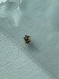 Jagged Little 4mm Stone Took About A Month To Pass After Diagnosis Still Have A 7mm To Pass Kidneystones