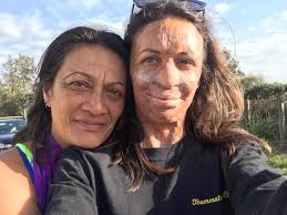 Turia Pitt