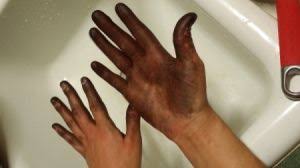 Getting Hair Dye Off Skin Brown Hair Dye Dyed Hair Blue Dyed Hair