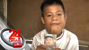 Batang may bukol sa mukha na dati nang tinulungan ng GMA Kapuso Foundation,  tinubuan ng...