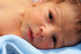When a baby's oil glands enlarge and open up in a few days or weeks, the white bumps disappear. Does Your Skin Have Tiny White Bumps Leave Them Alone Health Essentials From Cleveland Clinic
