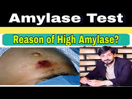 This video shows you how to pronounce blood in british english. How To Pronounce Amylase Howtopronounce Com