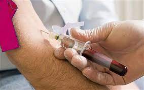 Proteina c reactiv este o protein folosit n diagnosticarea multor boli, fiind unul din indicatorii analizai i urmrii n evoluia bolii. Proteina C Reactiva Pcr I Medic Ro