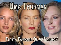 Uma thurman explains her 'weird' new look (and no, she hasn't had plastic surgery). Uma Thurman Plastic Fantastic Or Au Naturel Top Surgeon Weighs In Popdust