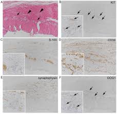 Gastrointestinal Tract Like Muscular Walls In Ovarian Mature