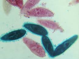 Cyclops, so named because it has only one eye. Viverwiz On Twitter Paramecium Whole Mount Magnified 100x By Light Microscopy Protozoa Ciliate Parasitology Microbiology Discover Science Explore Nature Https T Co Pvmoxeaohh