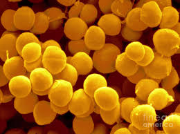 Image result for Staphylococcus Saprophyticus