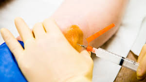 Image result for Knee Joint Injection