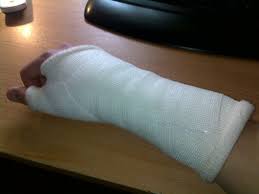 bilek kirilmasi skafoid kirigi bilmeyenadam