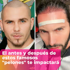 Famosos que se quedaron "pelones" y lucen irreconocibles
