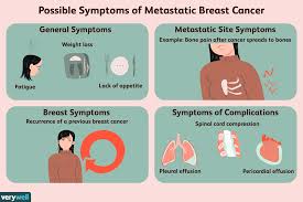 An early sign of inflammatory breast cancer is discoloration of the breast. Common Symptoms Of Metastatic Breast Cancer