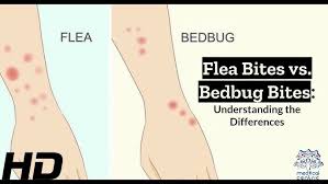 Image result for flea bites
