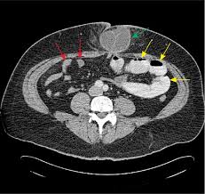 Cat anesthesia is extremely safe when the patients are stabilized before the procedure and all effort is made to have a good understanding of the cat's medical condition before surgery. Evaluation And Mangement Of Intestinal Obstruction American Family Physician