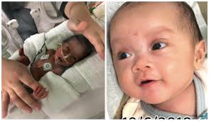 Pernahkah anda jatuh sakit untuk suatu jangka masa? Rasa Gelap Dunia Saya Lahir Pramatang Hanya Sebesar Botol Kicap Anak Disahkan Pula Jantung Berlubang