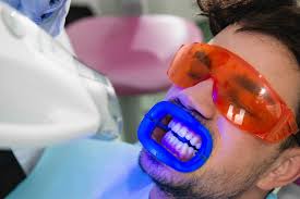 Many patients picture beautiful, white teeth when their braces come off. Professional Teeth Whitening Dentist Administered Whitening Treatments