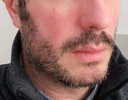 Just be sure that what you're buying is designed to trim stubble. Types Of Beard Problems That Men Face How To Deal With Them