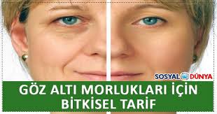 Goz Alti Morluklari Icin Bitkisel Tarifler Cilt Urunleri Cilt Bakimi Dogal Cilt Bakimi