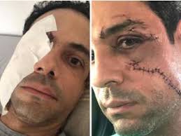 Quadrilha é presa com arma e veículos roubados